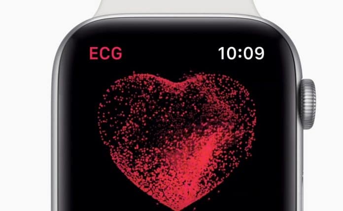 como hacer ecg apple watch como hacer ecg apple watch