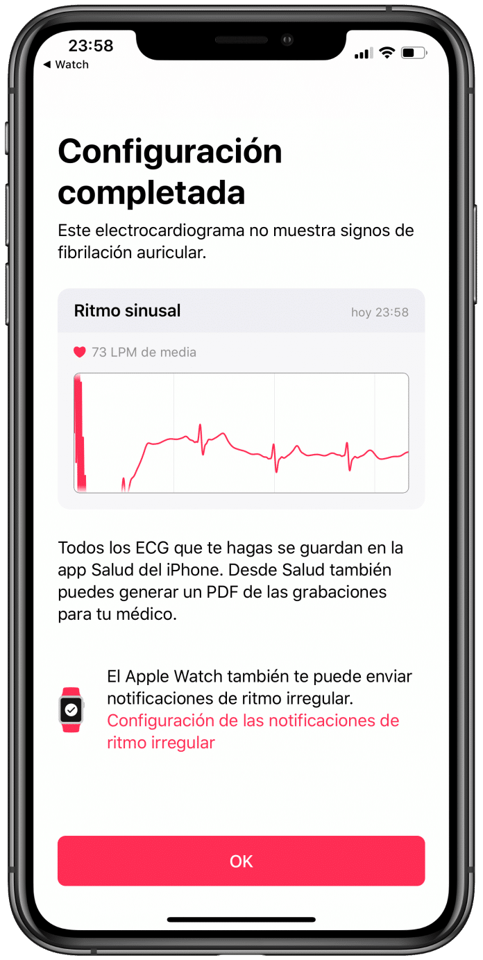 Cómo hacer un ECG en el Apple Watch Series 4